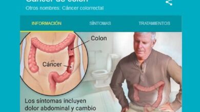 Prevenir cáncer de cólon es cambiar estilos de vida
