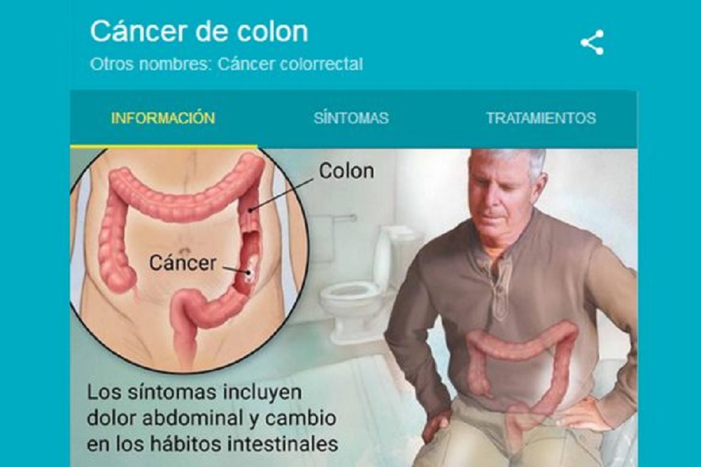 Prevenir cáncer de cólon es cambiar estilos de vida