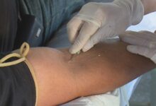 Donaciones de sangre sandino
